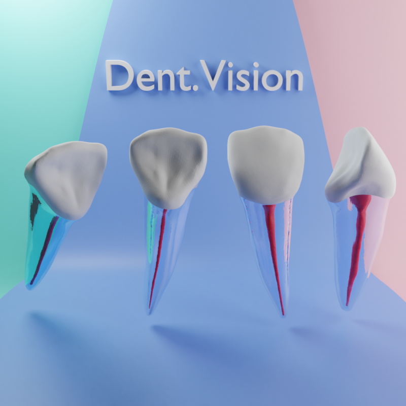 Endodontik şeffaf kanal tedavisi modeli, maxillar süt santral endodontik model