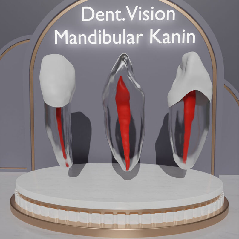 Dent.Vision Fuji Endo Endodontik Çene Uyumlu Kanallı Diş Modelleri Mandibular Kanin 33 No