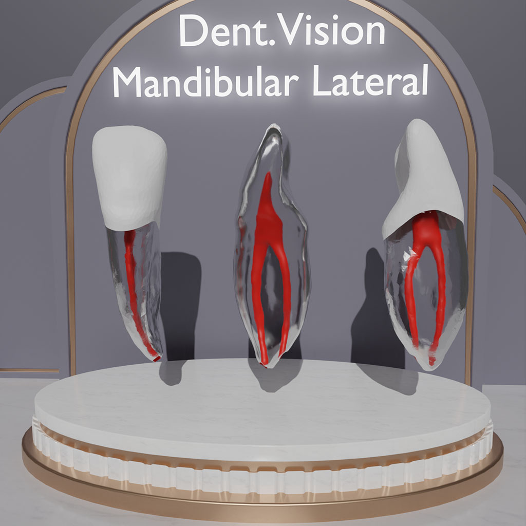 Dent.Vision Fuji Endo Endodontik Çene Uyumlu Kanallı Diş Modelleri Mandibular Lateral 32 No