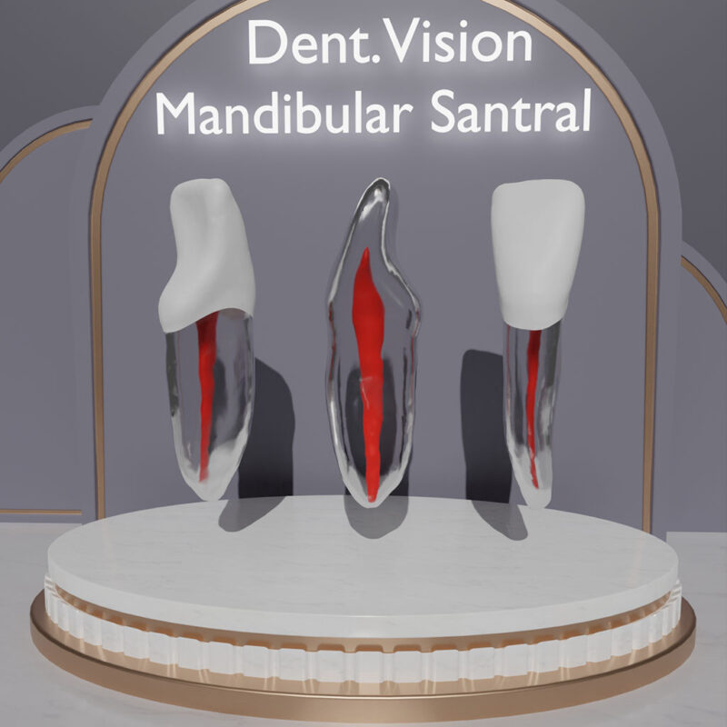 Dent.Vision Fuji Endo Endodontik Çene Uyumlu Kanallı Diş Modelleri Mandibular Santral 31 No