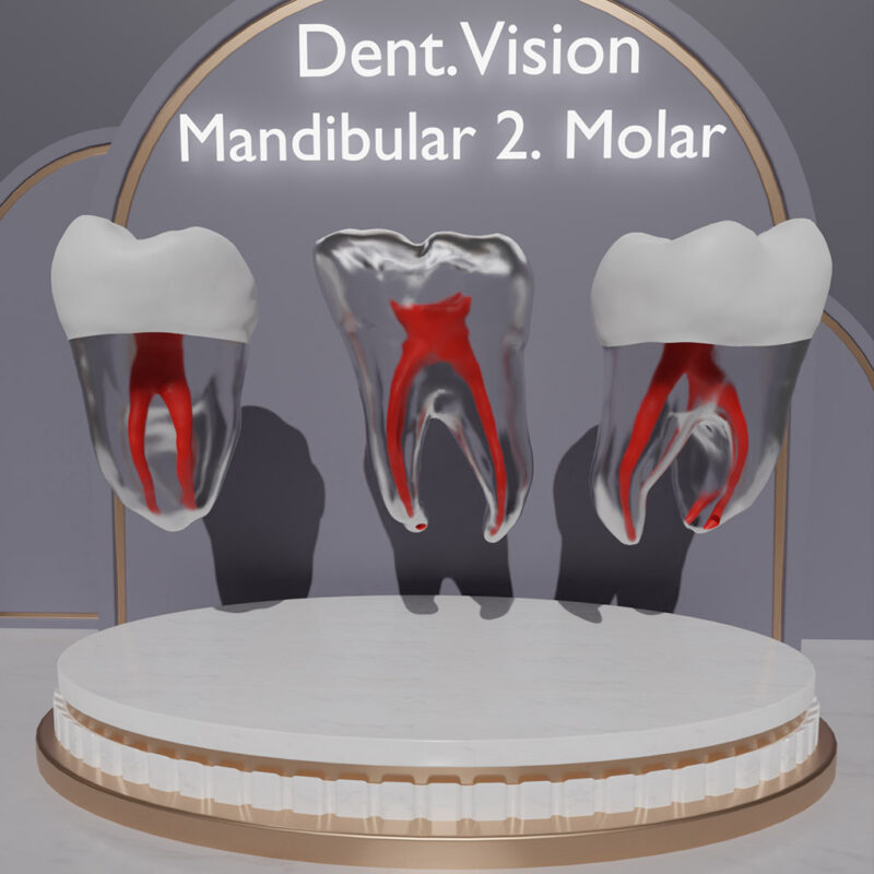 Dent.Vision Fuji Endo Endodontik Çene Uyumlu Kanallı Diş Modelleri Mandibular 2. Molar 37 No