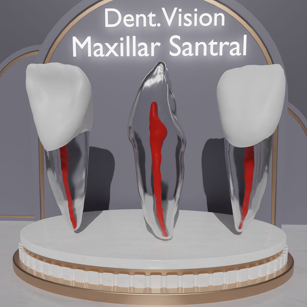 Dent.Vision Fuji Endo Endodontik Çene Uyumlu Kanallı Diş Modelleri Maxillar Santral 21 No